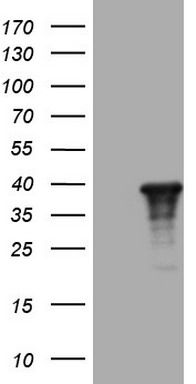HAVCR2 Antibody