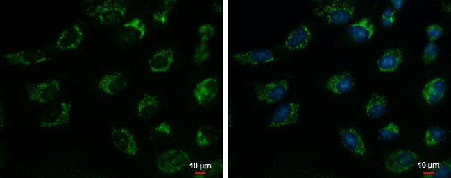 TIM17 Rabbit Polyclonal Antibody