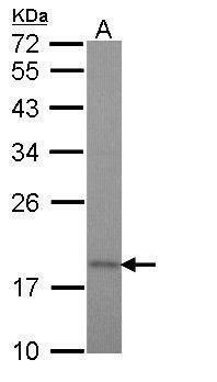 TIM17 Rabbit Polyclonal Antibody