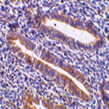 TIM Antibody