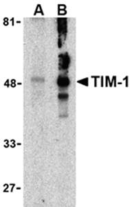 TIM Antibody