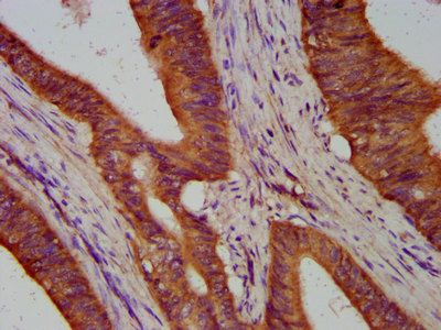 TIMELESS Antibody