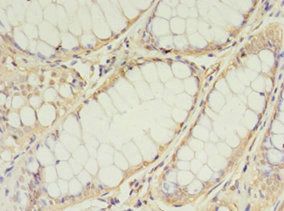 TIMM10 Antibody