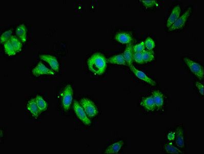 TIMM10B Antibody