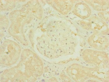 TIMM10B Antibody