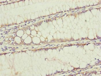 TIMM17B Antibody