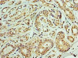 TIMM21 antibody