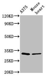 TIMMDC1 Antibody