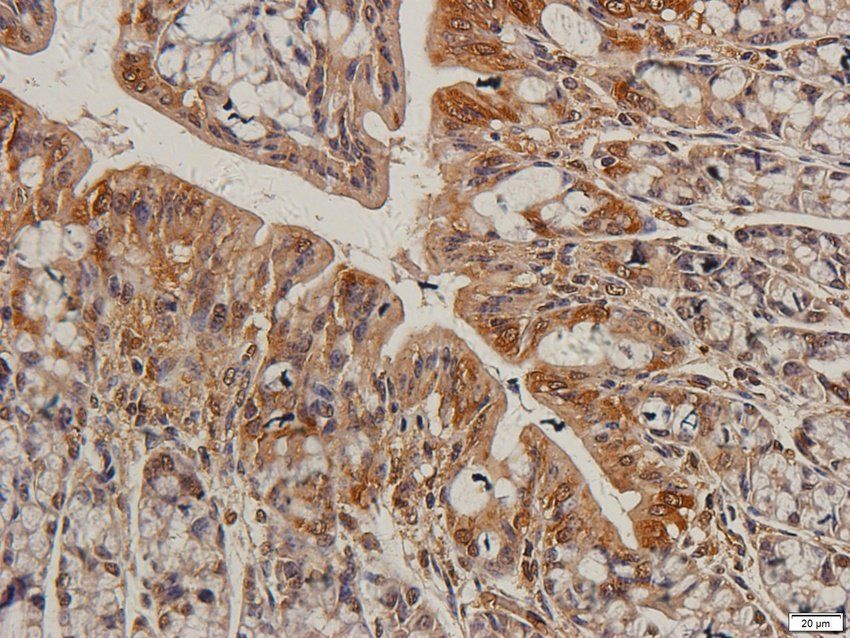 TIMP1 antibody