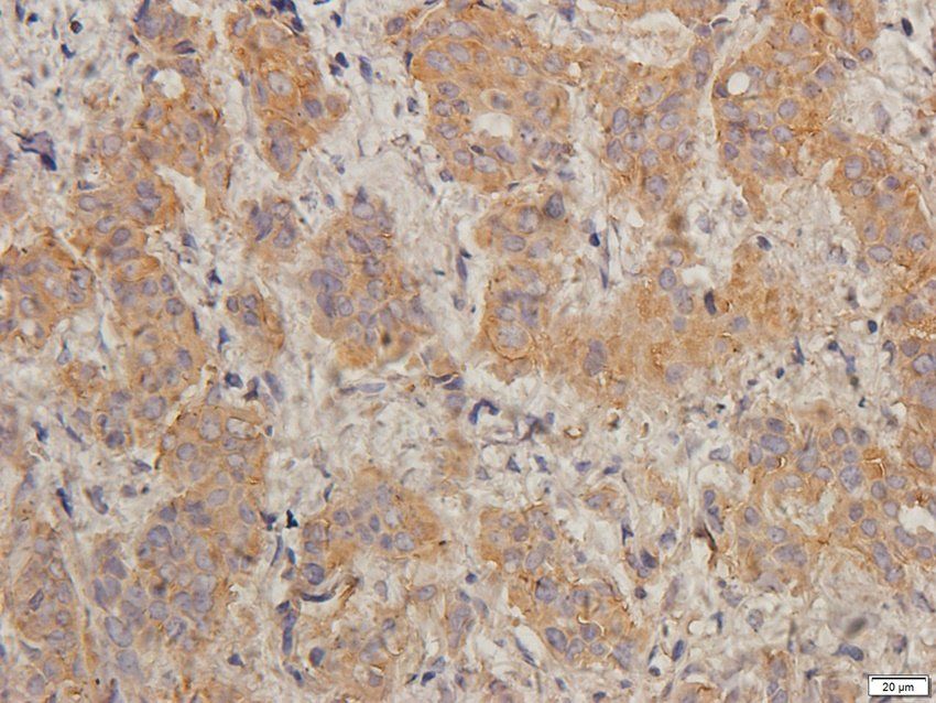 TIMP1 antibody