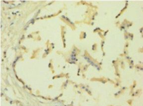 TIMP1 antibody