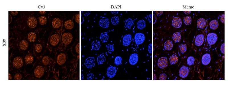 TIMP1 antibody