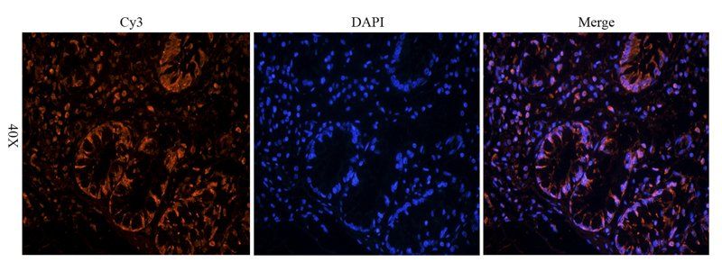 TIMP1 antibody