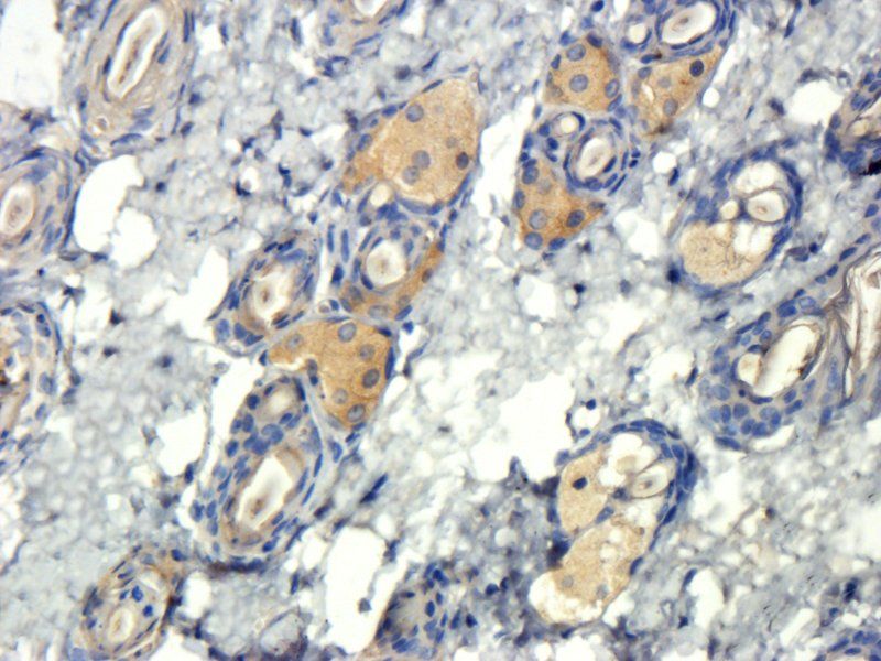 TIMP1 antibody