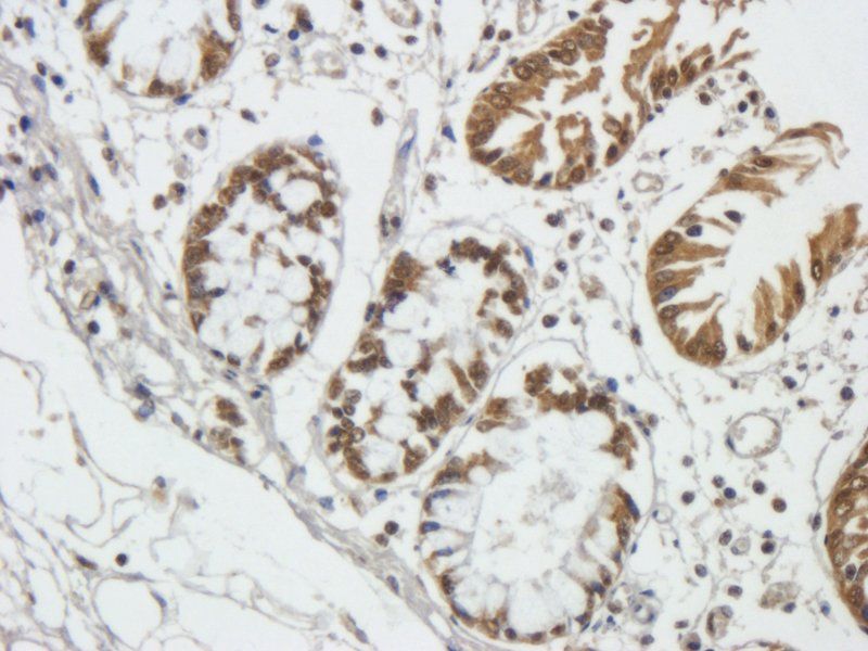 TIMP1 antibody