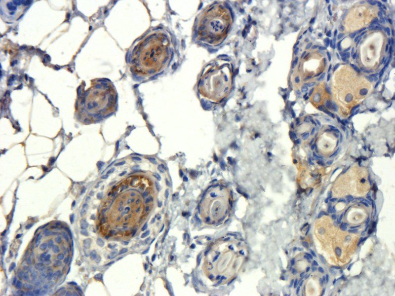 TIMP1 antibody