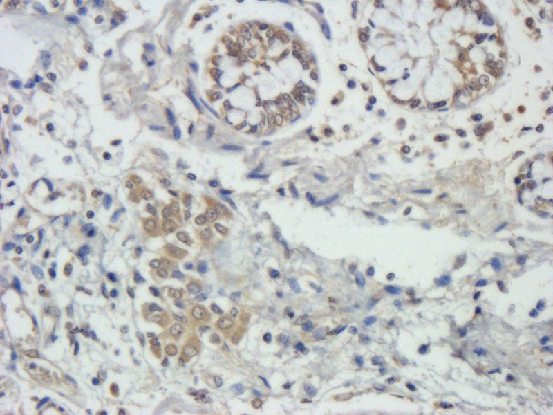 TIMP1 antibody