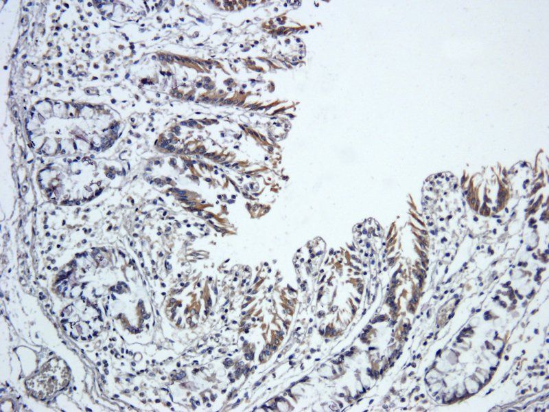 TIMP1 antibody