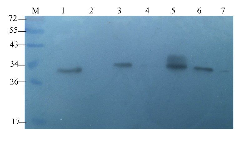 TIMP1 antibody