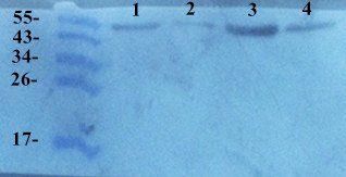 TIMP1 antibody