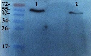 TIMP1 antibody