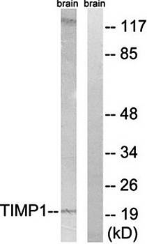 TIMP1 Antibody