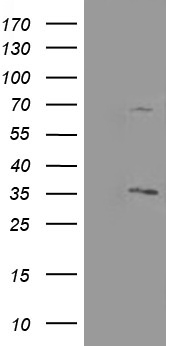 TIMP2 Antibody