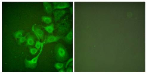 TIMP2 Antibody