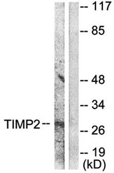 TIMP2 Antibody