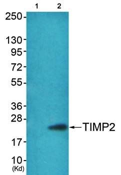 TIMP2 Antibody