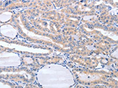 TIMP3 Antibody