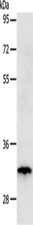 TIMP3 Antibody