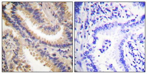 TIMP4 Antibody