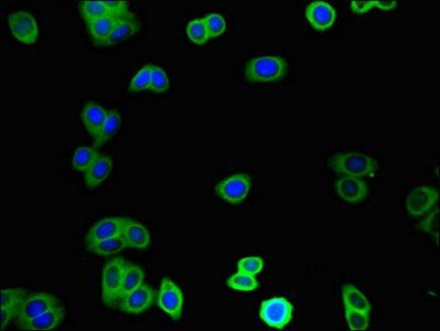 TINAGL1 antibody