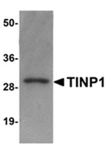 TINP1 Gallus Polyclonal Antibody