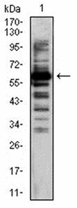 TIP60 Antibody