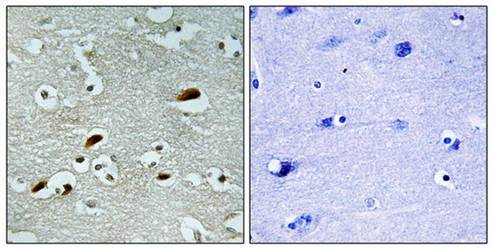 TIP60 Antibody