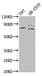 TIPARP Antibody