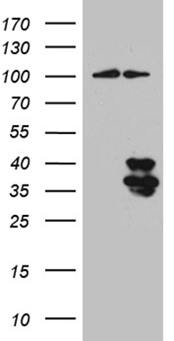 ZFP36L1 Antibody