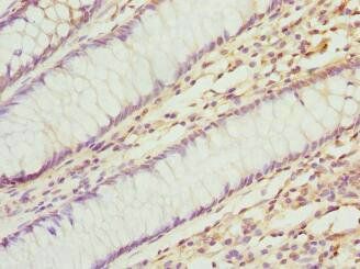 Tissue factor antibody