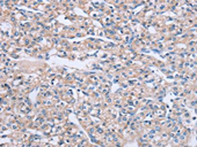 TF Antibody
