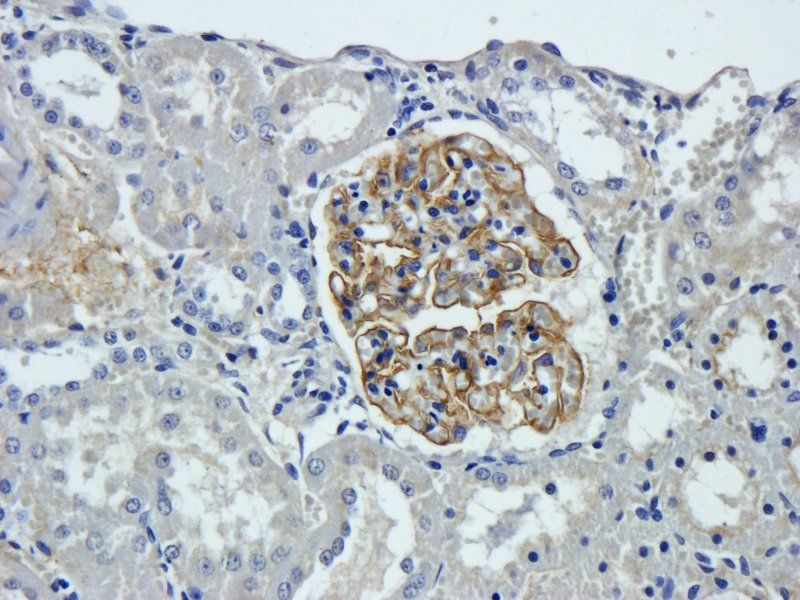 Tissue Factor antibody