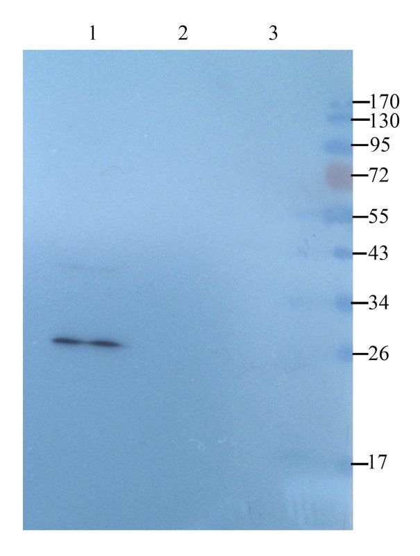 Tissue Factor antibody