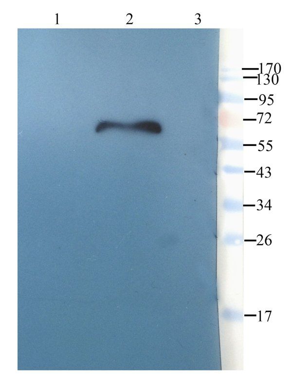 Tissue Factor antibody