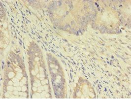 TK1 Antibody