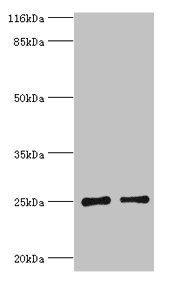 TK1 Antibody
