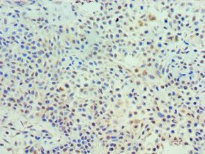 TK1 antibody