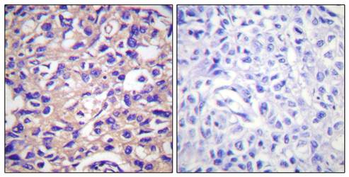 TK (phospho-Ser13) antibody