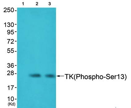 TK (phospho-Ser13) antibody