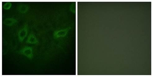 TK (Ab-13) Antibody
